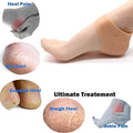 Kid Silicone Heel Protectors (1 Pair)